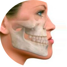 CIRURGIA ORTOGNÁTICA