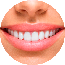 CLAREAMENTO DENTAL